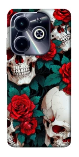 Чохол на Infinix Hot 40i skull and rose фото 1 з 1