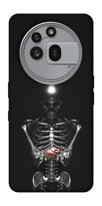 Чехол на Nothing Phone (3a) Pro Скелетон фото 1 из 1