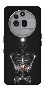 Чехол на Nothing Phone (3a) Pro Скелетон фото 1 из 1