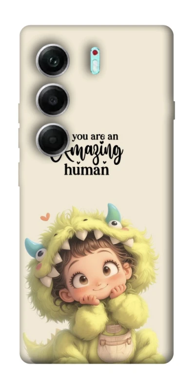 Чехол на Tecno Camon 40 Pro 5G You are amazing фото 1 из 1