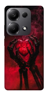 Чохол на Xiaomi Redmi Note 13 Pro 5G Heart in the hands of a skeleton фото 1 з 1