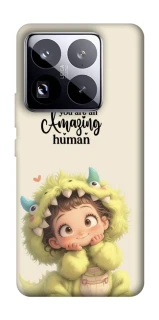 Чохол на Xiaomi 15 Pro You are amazing фото 1 з 1