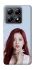 Чохол на Xiaomi 14T Ahyeon - BABYMONSTER фото 1 з 1