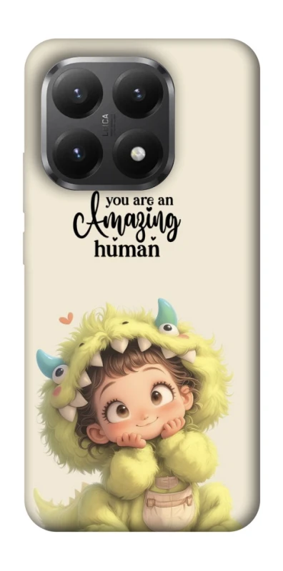 Чохол на Xiaomi 15T You are amazing фото 1 з 1