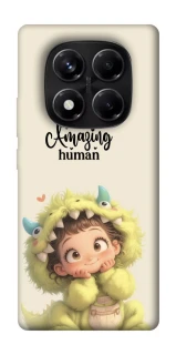 Чохол на Xiaomi Redmi Note 14 Pro 5G You are amazing фото 1 з 1