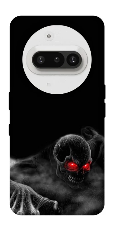 Чохол на Nothing Phone (3a) Skeleton v3 фото 1 з 1