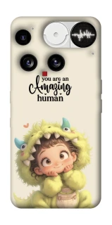 Чохол на Nothing Phone (3) You are amazing фото 1 з 1