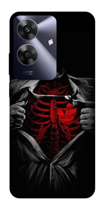 Чохол на Realme Note 60 Skeleton Heart фото 1 з 1