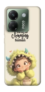 Чохол на Xiaomi Poco M7 pro 5G You are amazing фото 1 з 1