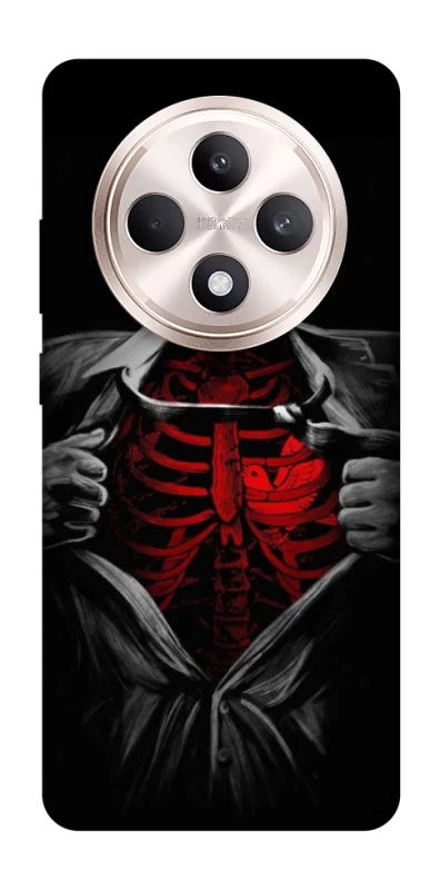 Чохол на Oppo Reno 12 F 4G/5G Skeleton Heart фото 1 з 1