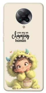 Чохол на Xiaomi Redmi K30 Pro / Poco F2 Pro You are amazing фото 1 з 1