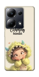 Чохол на Xiaomi Poco M6 Pro 4G You are amazing фото 1 з 1