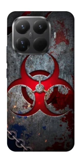 Чохол на Xiaomi 15T Pro Радіація v3 фото 1 з 1