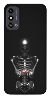 Чехол на ZTE Blade A53 Скелетон фото 1 из 1