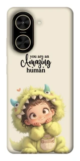 Чохол на Xiaomi Poco C71 You are amazing фото 1 з 1