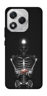 Чохол на Honor 400 Lite Скелетон фото 1 з 1
