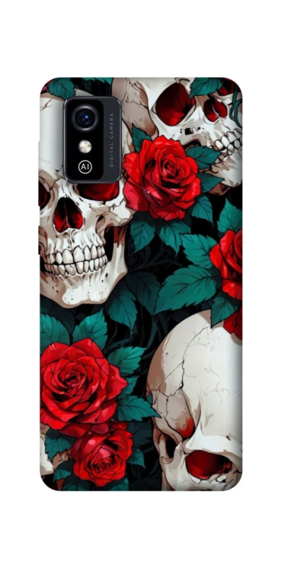 Чохол на ZTE Blade L9 skull and rose фото 1 з 1