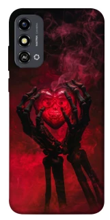Чехол на ZTE Blade A53 Heart in the hands of a skeleton фото 1 из 1