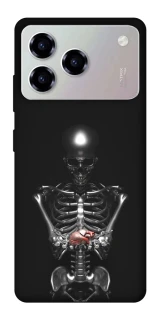 Чохол на ZTE Blade A76 Скелетон фото 1 з 1