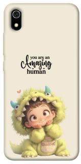 Чехол на Xiaomi Redmi 7A You are amazing фото 1 из 1