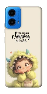 Чохол на Motorola Moto G45 You are amazing фото 1 з 1