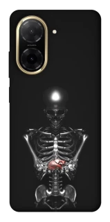 Чохол на Xiaomi Redmi A5 (Europe version) Скелетон фото 1 з 1