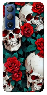 Чохол на TECNO Pop 5 LTE skull and rose фото 1 з 1