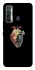Чехол на TECNO Camon 17 Heart with flowers фото 1 из 1