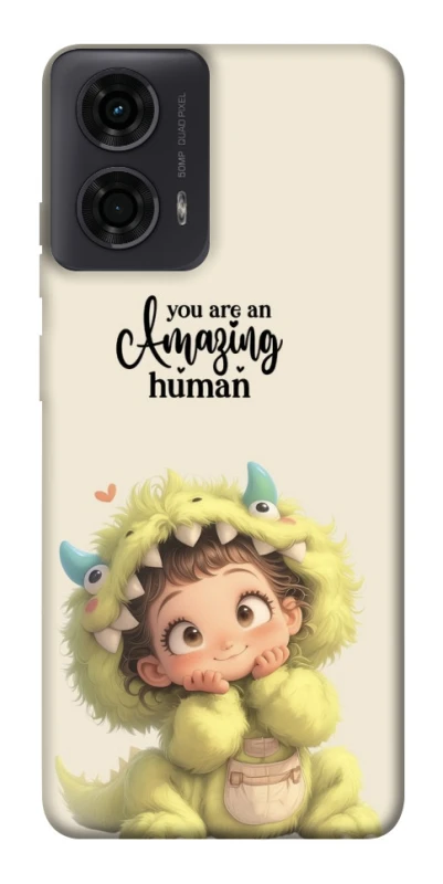 Чохол на Motorola Moto G24 You are amazing фото 1 з 1