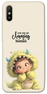 Чехол на Xiaomi Redmi 9A You are amazing фото 1 из 1