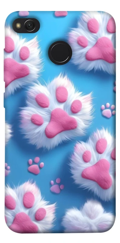 Чохол на Xiaomi Redmi 4X Cat paw фото 1 з 1