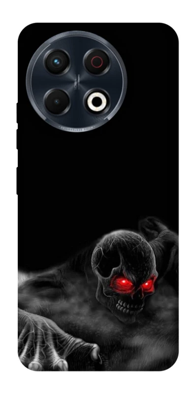 Чохол на TECNO Spark 30 Pro (KL7) Skeleton v3 фото 1 з 1