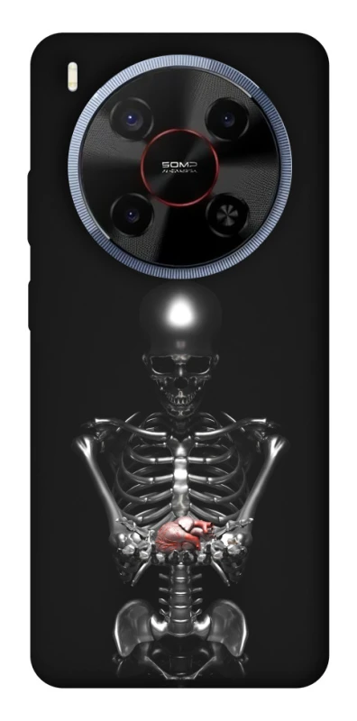 Чохол на ZTE Blade V70 Max Скелетон фото 1 з 1