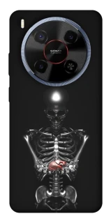 Чохол на ZTE Blade V70 Max Скелетон фото 1 з 1