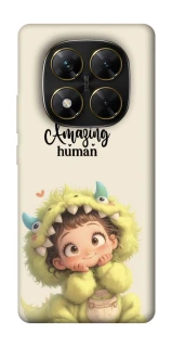 Чохол на Xiaomi Poco X7 You are amazing фото 1 з 1