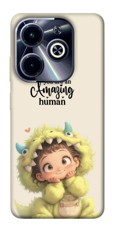 Чехол на Infinix Hot 40i You are amazing фото 1 из 1