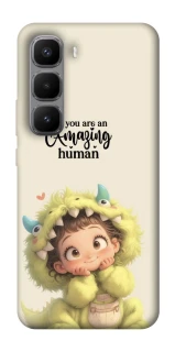 Чехол на Infinix Hot 60 Pro+ You are amazing фото 1 из 1