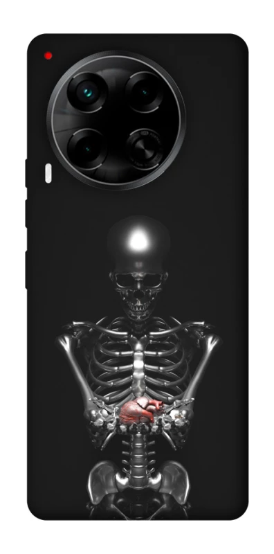 Чохол на TECNO Camon 30 (CL6) Скелетон фото 1 з 1