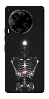 Чохол на TECNO Camon 30 (CL6) Скелетон фото 1 з 1