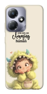 Чехол на Infinix Hot 30i You are amazing фото 1 из 1