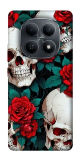 Чохол на Xiaomi Redmi Note 15 4G/5G (EU) skull and rose фото 1 з 1