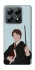 Чохол на Xiaomi 14T Harry Potter v5 фото 1 з 1