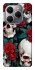 Чохол на TECNO Spark 20 Pro skull and rose фото 1 з 1