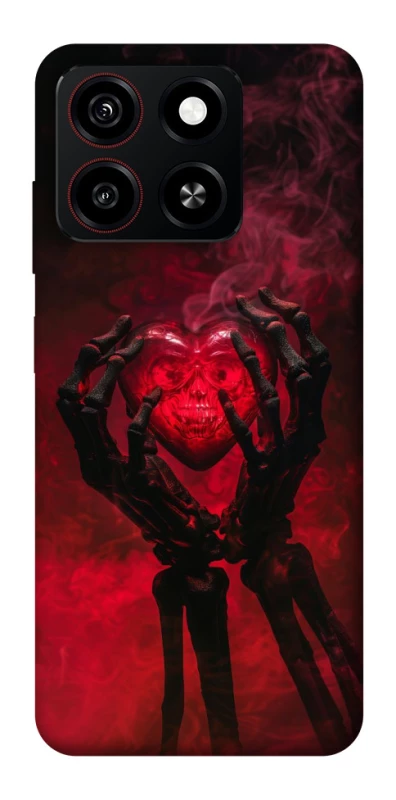 Чохол на ZTE Blade A35 4G Heart in the hands of a skeleton фото 1 з 1