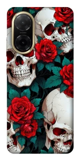 Чохол на Xiaomi Redmi A5 (Europe version) skull and rose фото 1 з 1