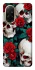 Чохол на Xiaomi Redmi A5 (Europe version) skull and rose фото 1 з 1