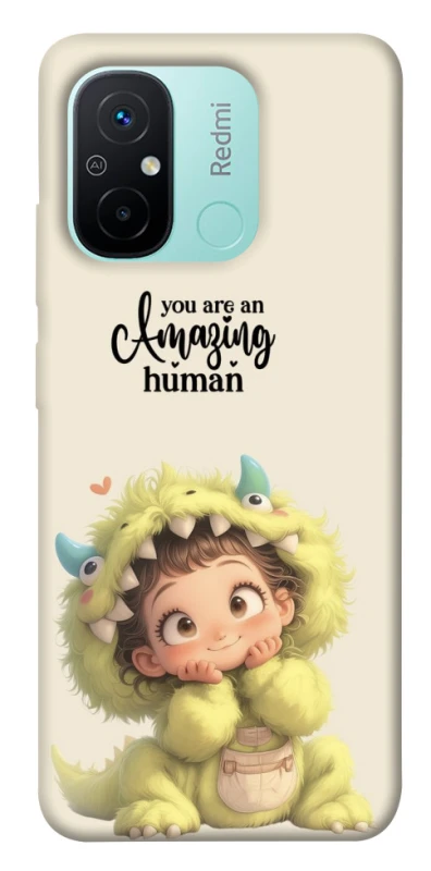 Чохол на Xiaomi Redmi 12C / Poco C55 You are amazing фото 1 з 1
