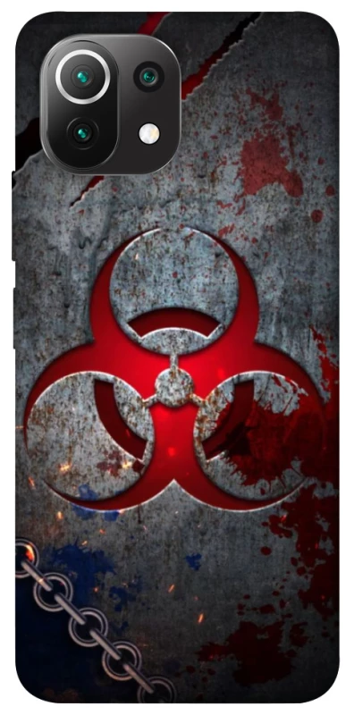 Чохол на Xiaomi Mi 11 Lite Радіація v3 фото 1 з 1