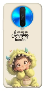 Чехол на Xiaomi Redmi K30 You are amazing фото 1 из 1