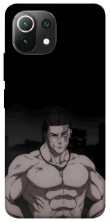 Чехол на Xiaomi Mi 11 Lite Todo фото 1 из 1